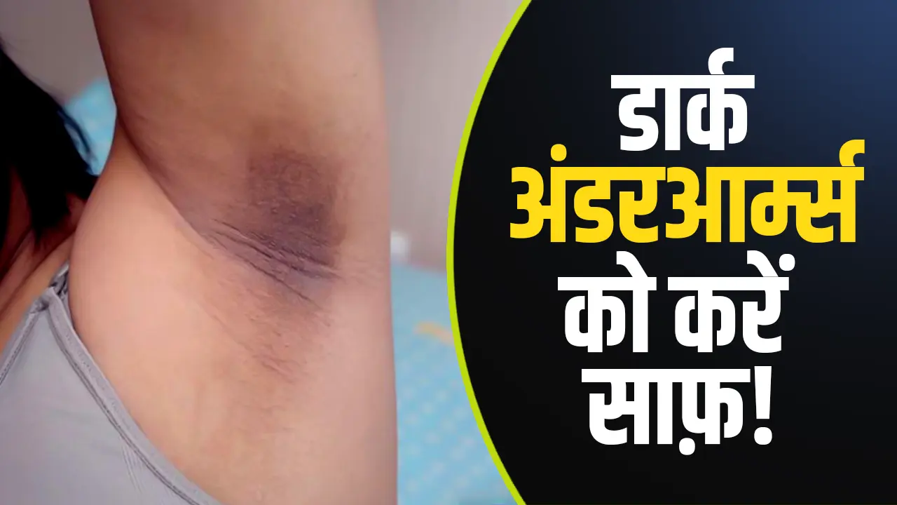 डार्क अंडरआर्म्स को करें साफ़! ये घरेलू नुस्खे देंगे तुरंत असर